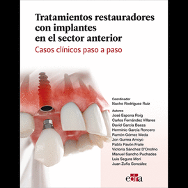 Tratamientos restauradores con implantes en el sector anterior.