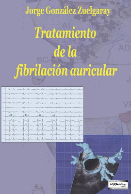 Tratamiento de la fibrilacin auricular